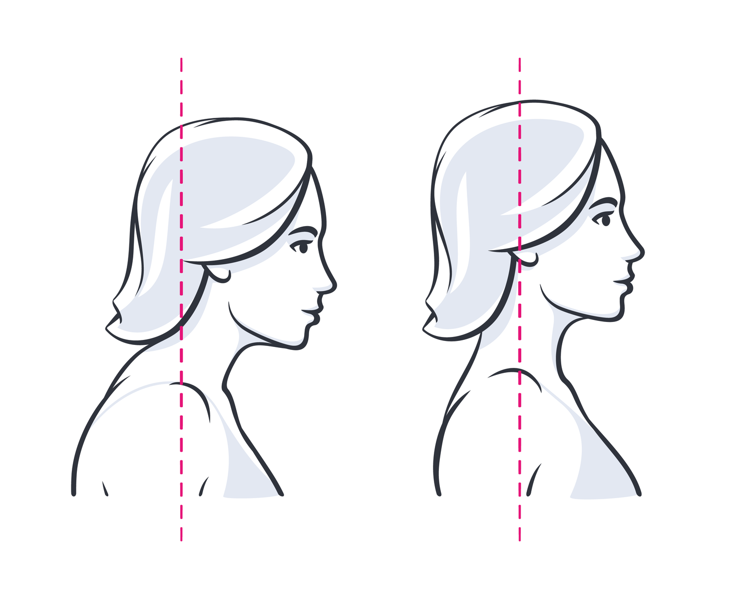 Neck stretcher posture 