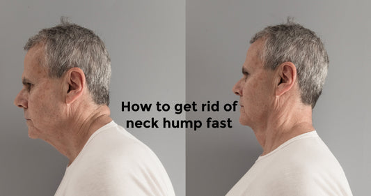 How to get rid of neck hump fast